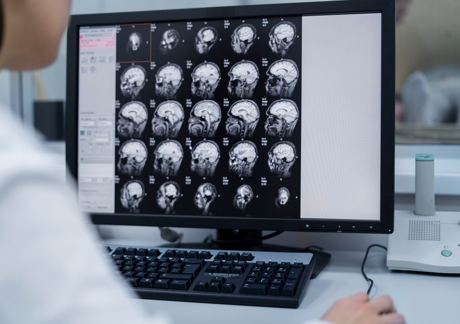    ?  MRI    